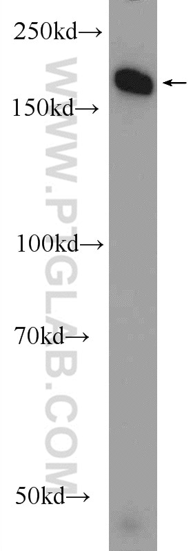 Western Blot (WB) analysis of HEK-293 cells using DNMT1 Polyclonal antibody (24206-1-AP)