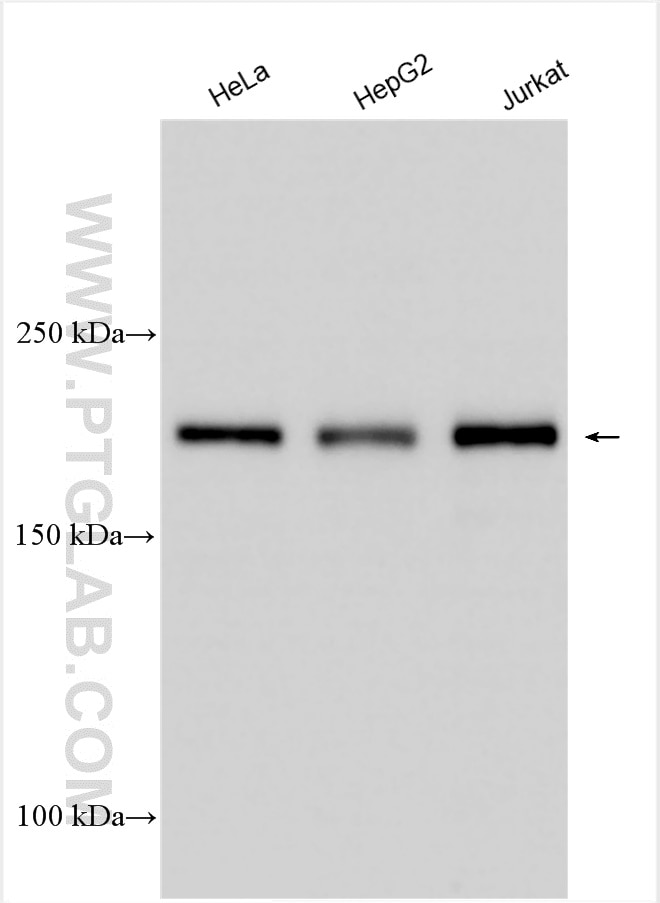 Western Blot (WB) analysis of various lysates using DNMT1 Polyclonal antibody (24206-1-AP)
