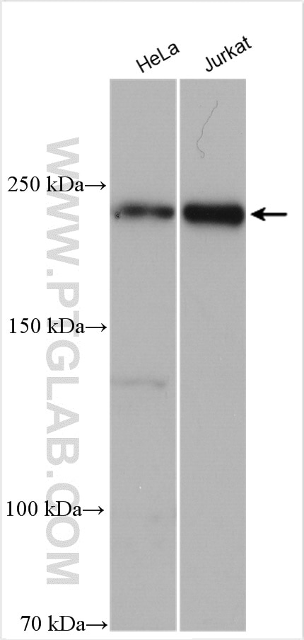 Western Blot (WB) analysis of various lysates using DNMT1 Polyclonal antibody (28754-1-AP)