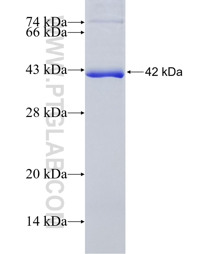 DNMT1 fusion protein Ag19116 SDS-PAGE