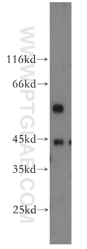 WB analysis of HeLa using 19221-1-AP