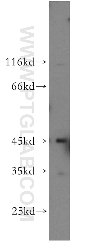 DNMT2 Polyclonal antibody