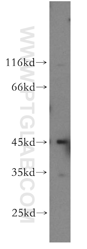 Western Blot (WB) analysis of HeLa cells using DNMT2 Polyclonal antibody (19221-1-AP)