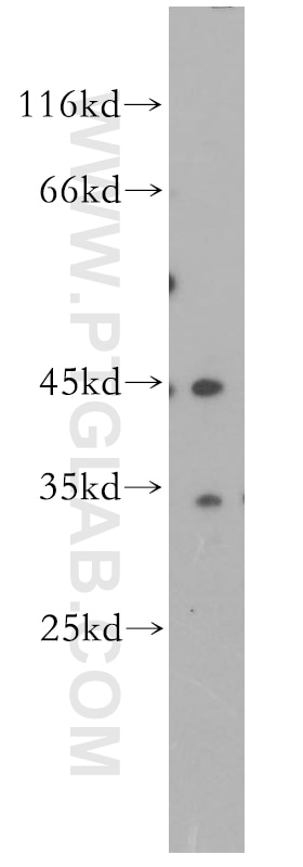 Western Blot (WB) analysis of MCF-7 cells using DNMT2 Polyclonal antibody (19221-1-AP)