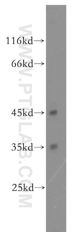 Western Blot (WB) analysis of HEK-293 cells using DNMT2 Polyclonal antibody (19221-1-AP)