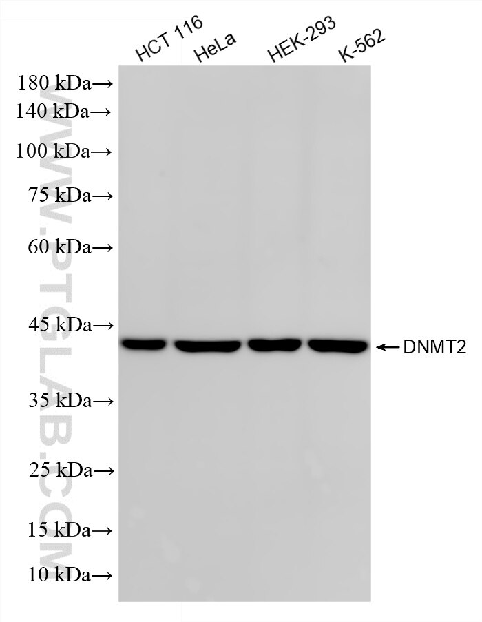 WB analysis using 87236-1-RR (same clone as 87236-1-PBS) Western Blot (WB) analysis of various lysates using DNMT2 Recombinant monoclonal antibody (87236-1-RR)