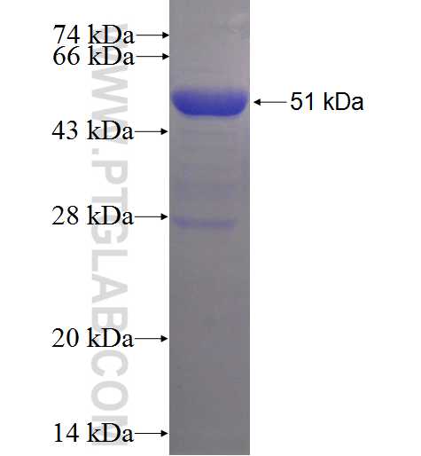 DNMT2 fusion protein Ag5571 SDS-PAGE