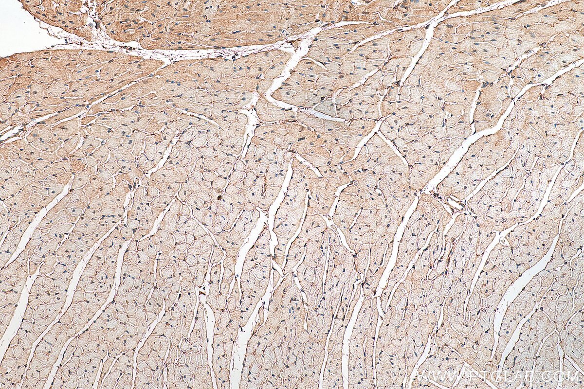 Immunohistochemistry (IHC) staining of mouse heart tissue using DNMT3A Polyclonal antibody (19366-1-AP)