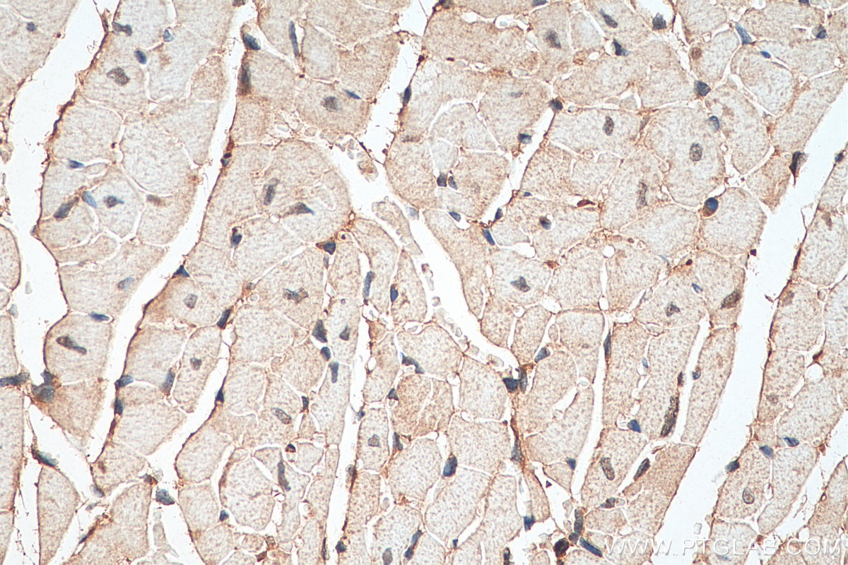 Immunohistochemistry (IHC) staining of mouse heart tissue using DNMT3A Polyclonal antibody (19366-1-AP)