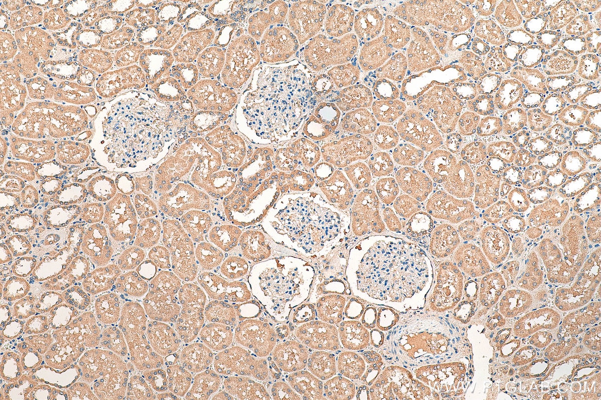 Immunohistochemistry (IHC) staining of human kidney tissue using DNMT3A Polyclonal antibody (19366-1-AP)