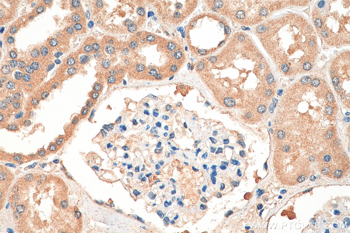 Immunohistochemistry (IHC) staining of human kidney tissue using DNMT3A Polyclonal antibody (19366-1-AP)