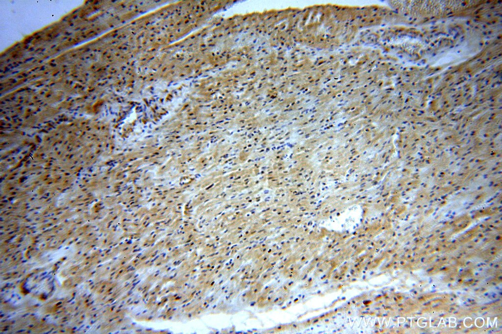 Immunohistochemistry (IHC) staining of human heart tissue using DNMT3A Polyclonal antibody (19366-1-AP)