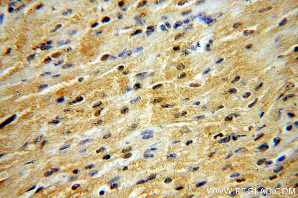 Immunohistochemistry (IHC) staining of human heart tissue using DNMT3A Polyclonal antibody (19366-1-AP)