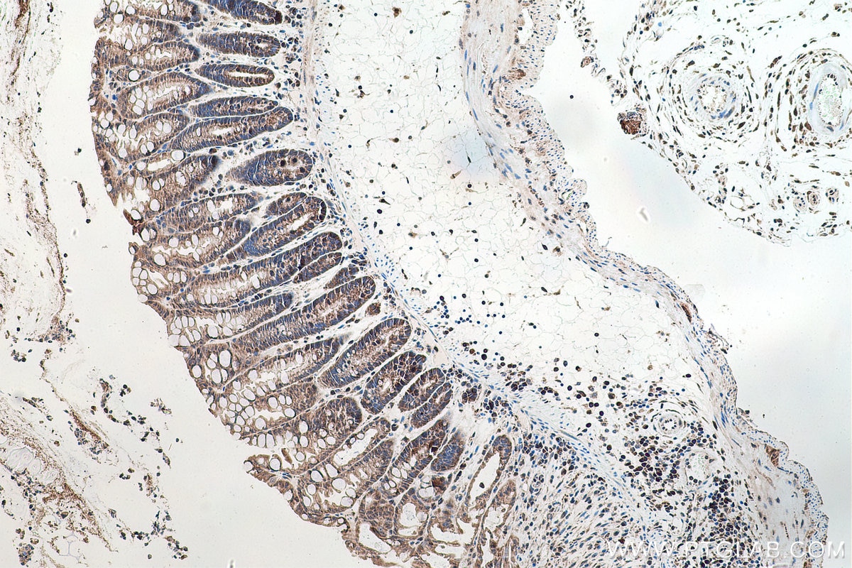 Immunohistochemistry (IHC) staining of mouse colon tissue using DNMT3A Polyclonal antibody (20954-1-AP)