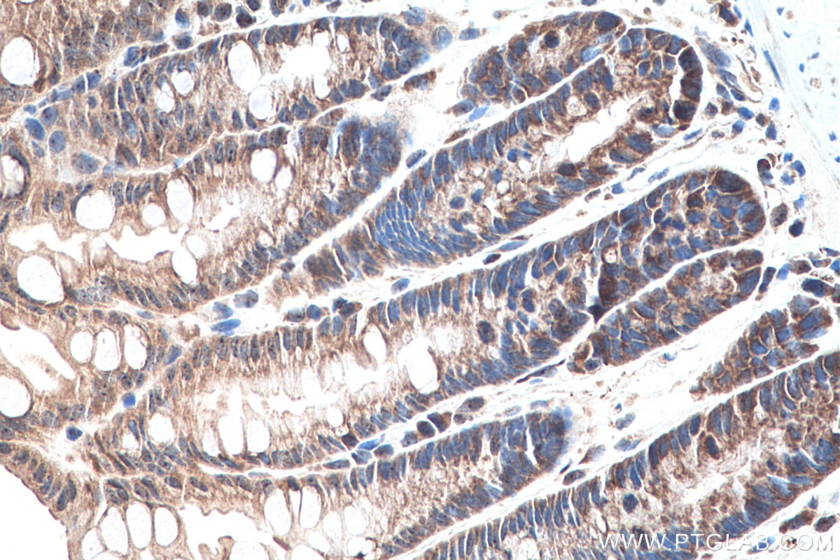 Immunohistochemistry (IHC) staining of mouse colon tissue using DNMT3A Polyclonal antibody (20954-1-AP)