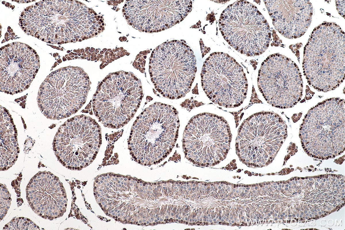 Immunohistochemistry (IHC) staining of mouse testis tissue using DNMT3A Polyclonal antibody (20954-1-AP)