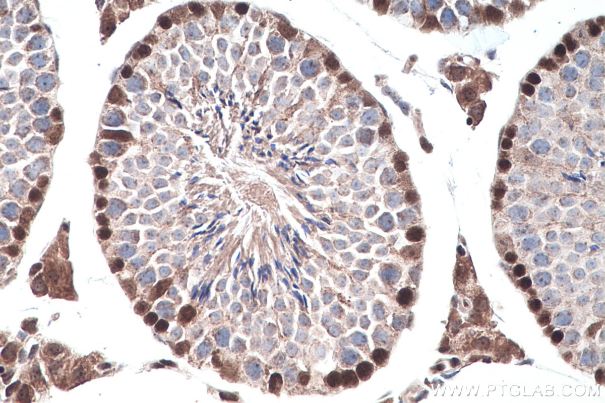 Immunohistochemistry (IHC) staining of mouse testis tissue using DNMT3A Polyclonal antibody (20954-1-AP)