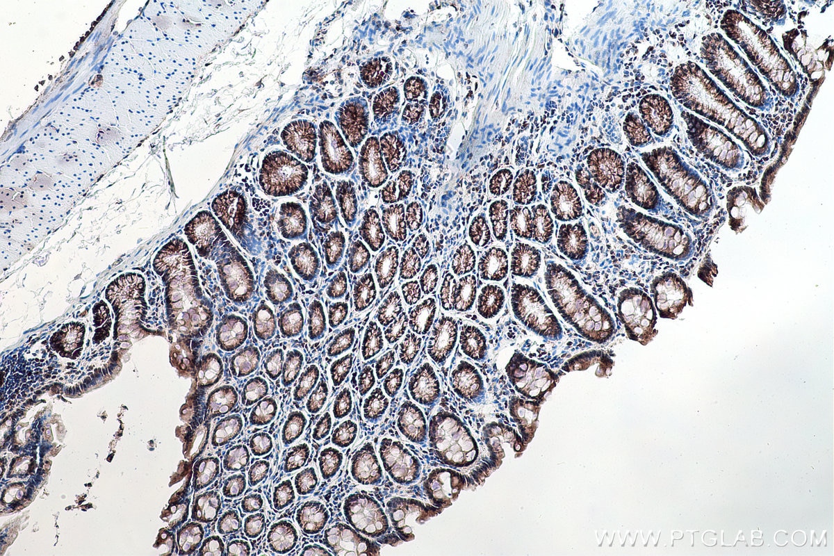 Immunohistochemistry (IHC) staining of rat colon tissue using DNMT3A Polyclonal antibody (20954-1-AP)