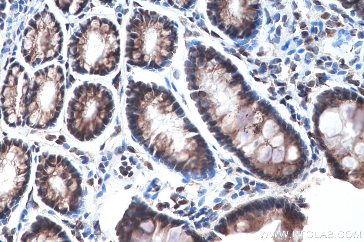 Immunohistochemistry (IHC) staining of rat colon tissue using DNMT3A Polyclonal antibody (20954-1-AP)
