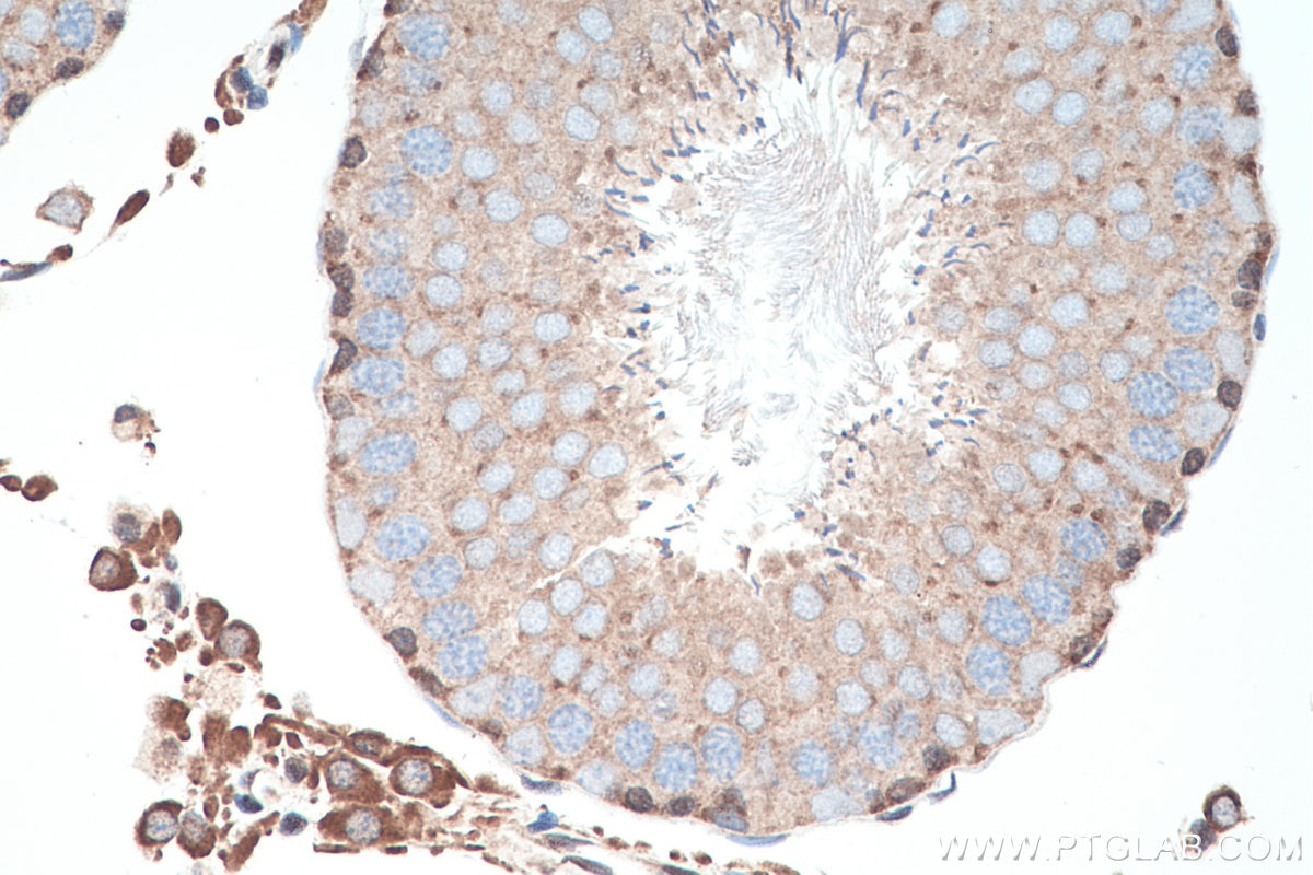 Immunohistochemistry (IHC) staining of rat testis tissue using DNMT3A Polyclonal antibody (20954-1-AP)