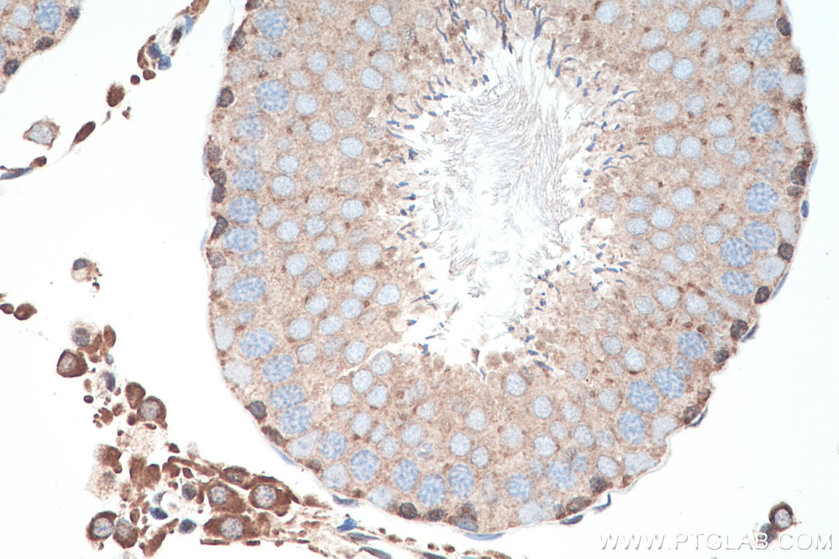 IHC staining of rat testis using 20954-1-AP