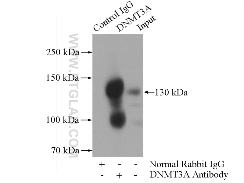 Immunoprecipitation (IP) experiment of HeLa cells using DNMT3A Polyclonal antibody (20954-1-AP)