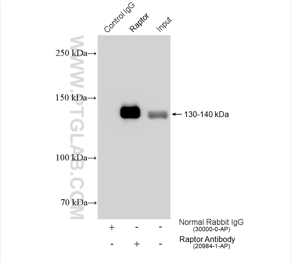 IP experiment of HeLa using 20954-1-AP