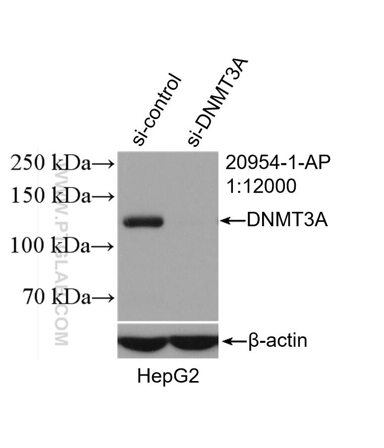 Western Blot (WB) analysis of HepG2 cells using DNMT3A Polyclonal antibody (20954-1-AP)