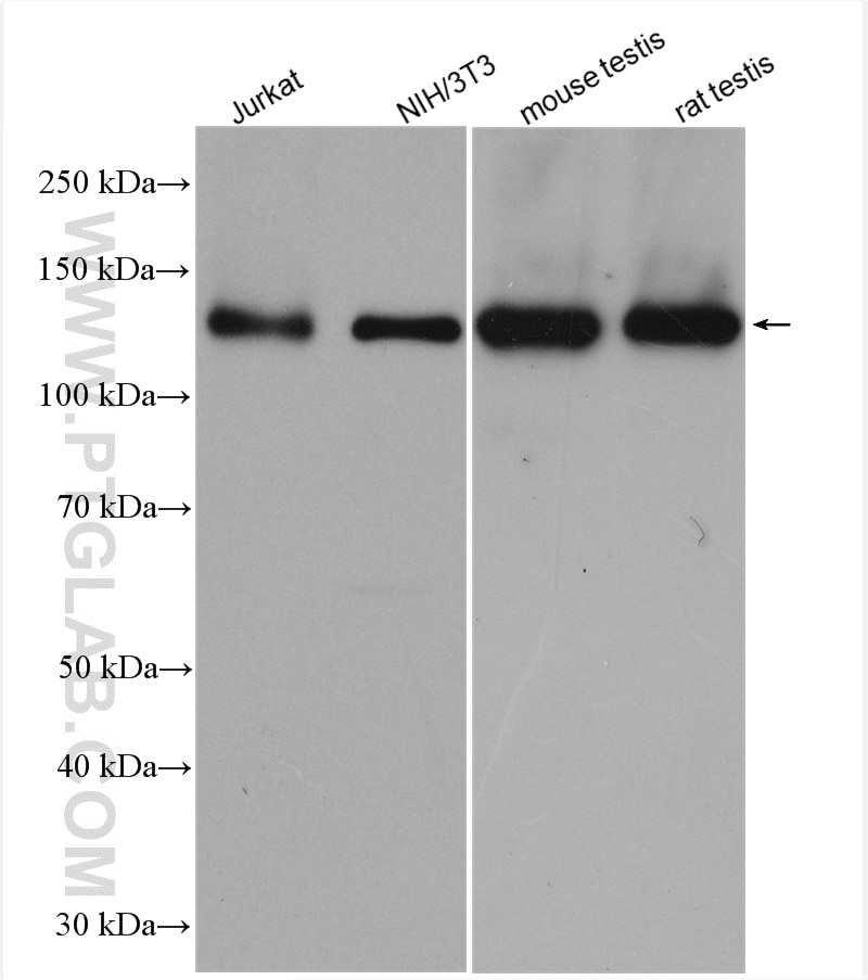 Western Blot (WB) analysis of various lysates using DNMT3A Polyclonal antibody (20954-1-AP)
