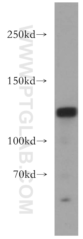 DNMT3A Polyclonal antibody