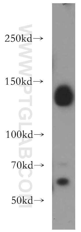 DNMT3A Polyclonal antibody