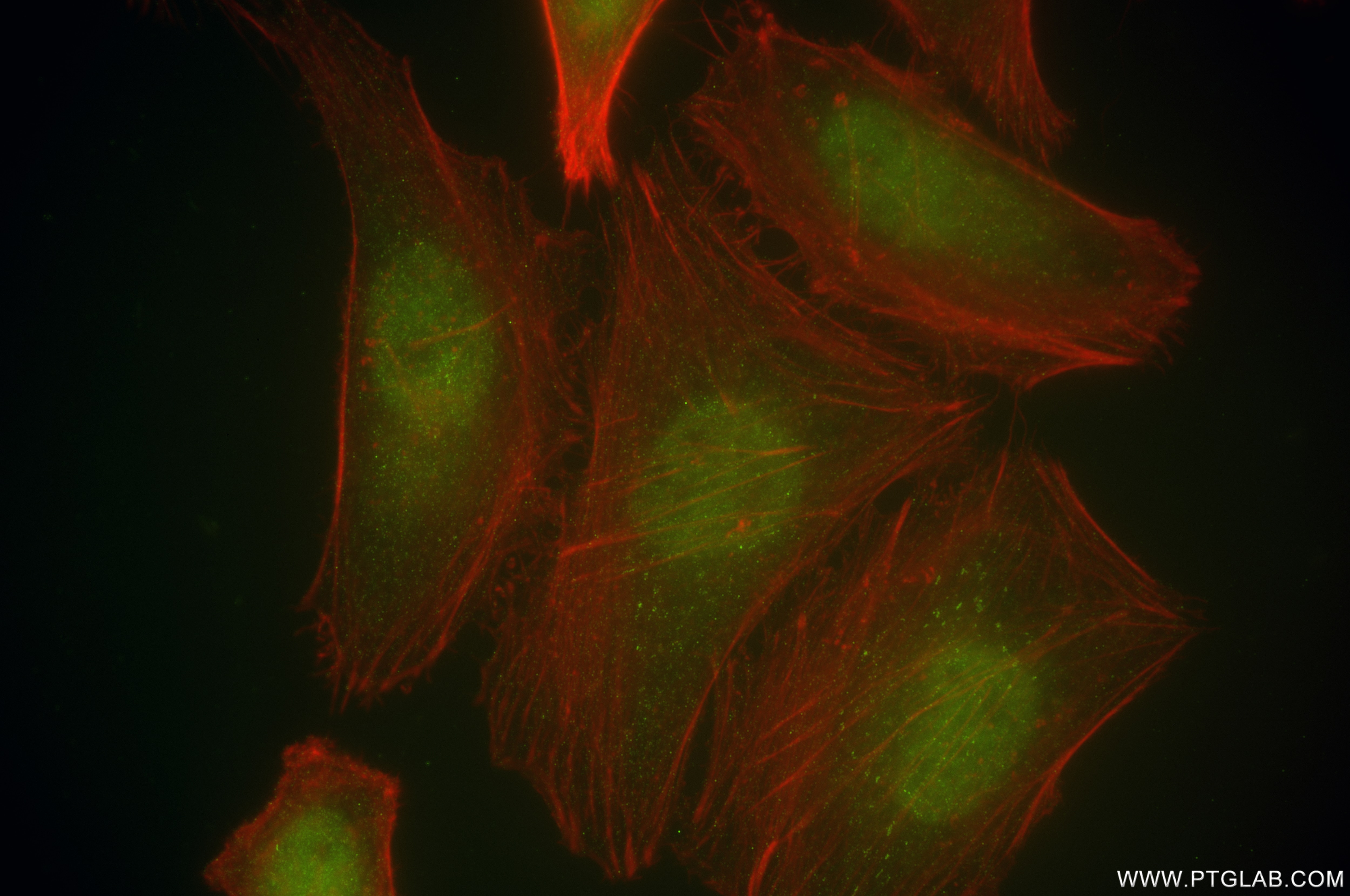 Immunofluorescence (IF) / fluorescent staining of HeLa cells using DNMT3A Recombinant monoclonal antibody, PBS Only (81474-6-PBS)
