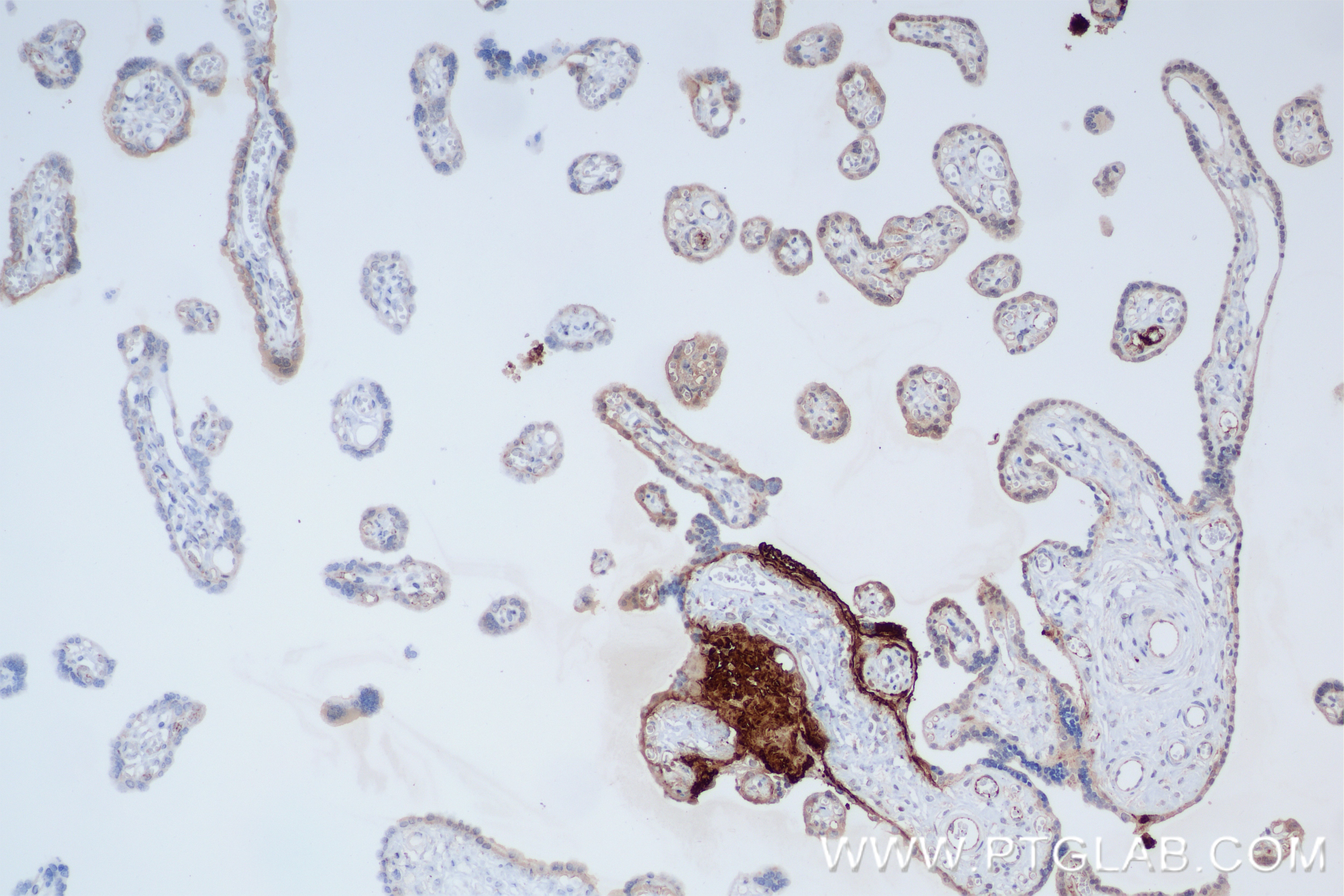 Immunohistochemistry (IHC) staining of human placenta tissue using DNMT3A Recombinant antibody (81474-6-RR)