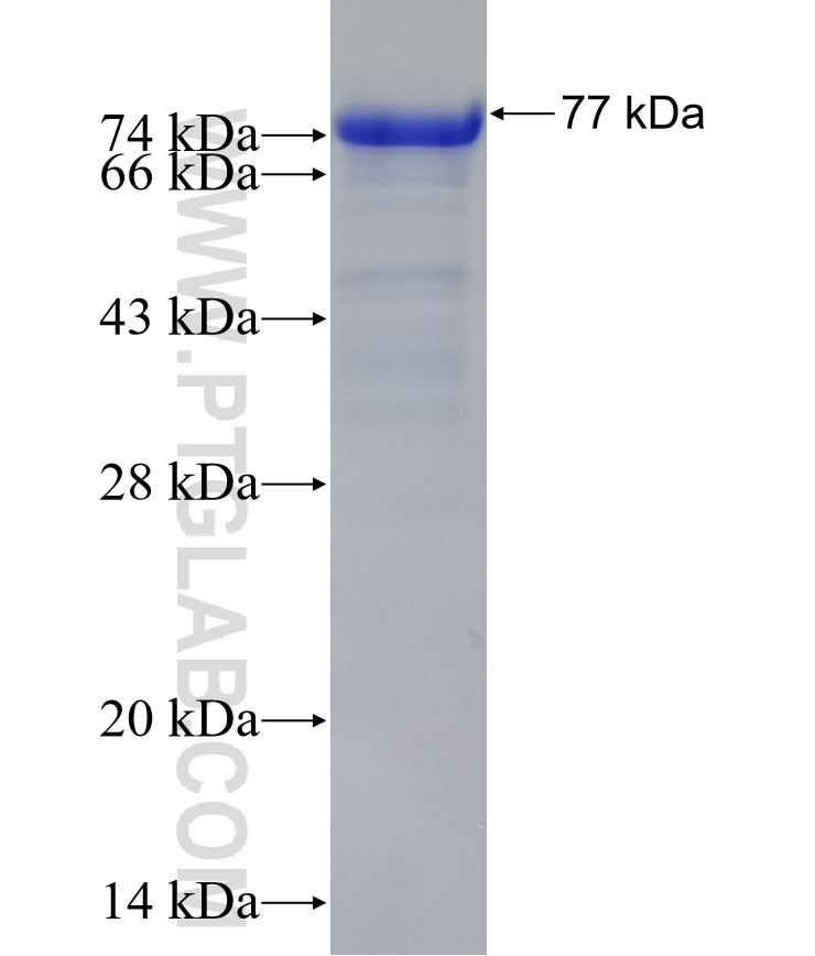 DNMT3A fusion protein Ag15111 SDS-PAGE