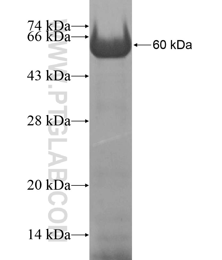 DNMT3A fusion protein Ag17117 SDS-PAGE
