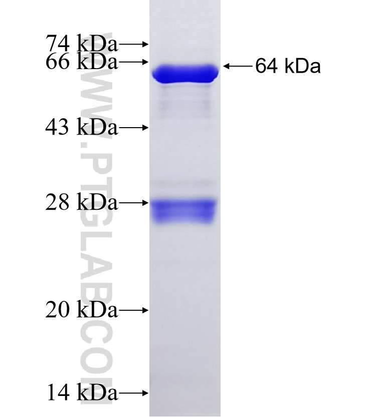 DNMT3A fusion protein Ag6271 SDS-PAGE