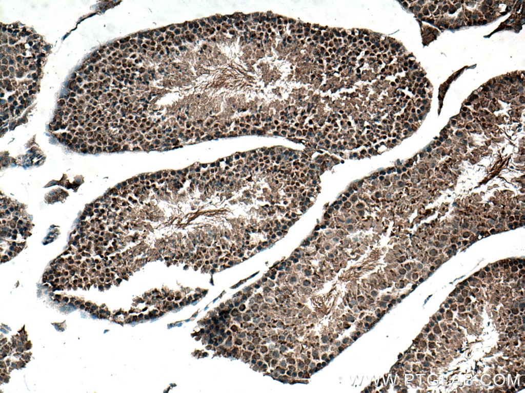 Immunohistochemistry (IHC) staining of mouse testis tissue using DNMT3B Polyclonal antibody (26971-1-AP)