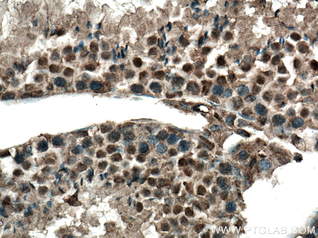 Immunohistochemistry (IHC) staining of mouse testis tissue using DNMT3B Polyclonal antibody (26971-1-AP)