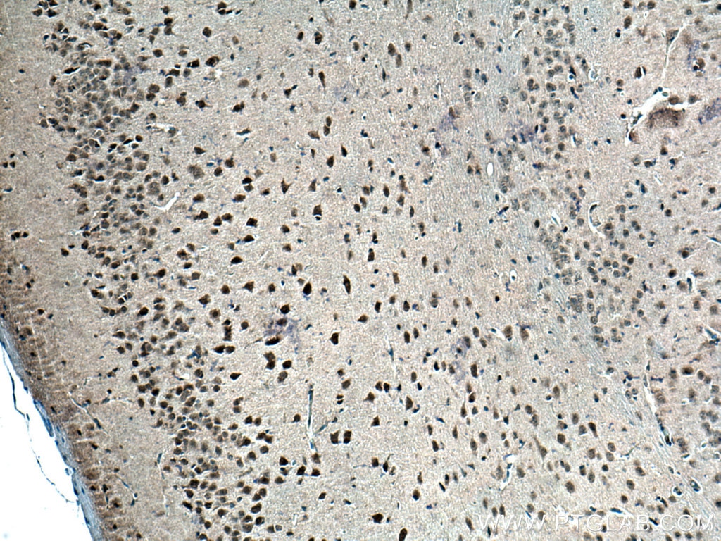 Immunohistochemistry (IHC) staining of mouse brain tissue using DNMT3B Polyclonal antibody (26971-1-AP)