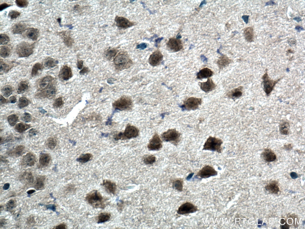 Immunohistochemistry (IHC) staining of mouse brain tissue using DNMT3B Polyclonal antibody (26971-1-AP)