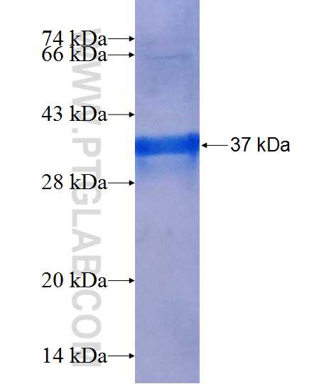 DNMT3B fusion protein Ag25117 SDS-PAGE