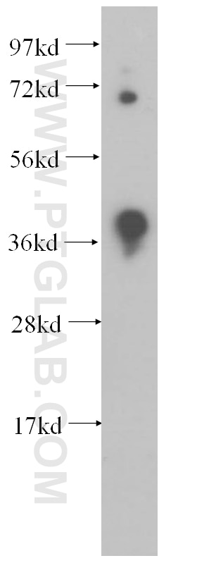 Western Blot (WB) analysis of PC-3 cells using DNMT3L Polyclonal antibody (14939-1-AP)