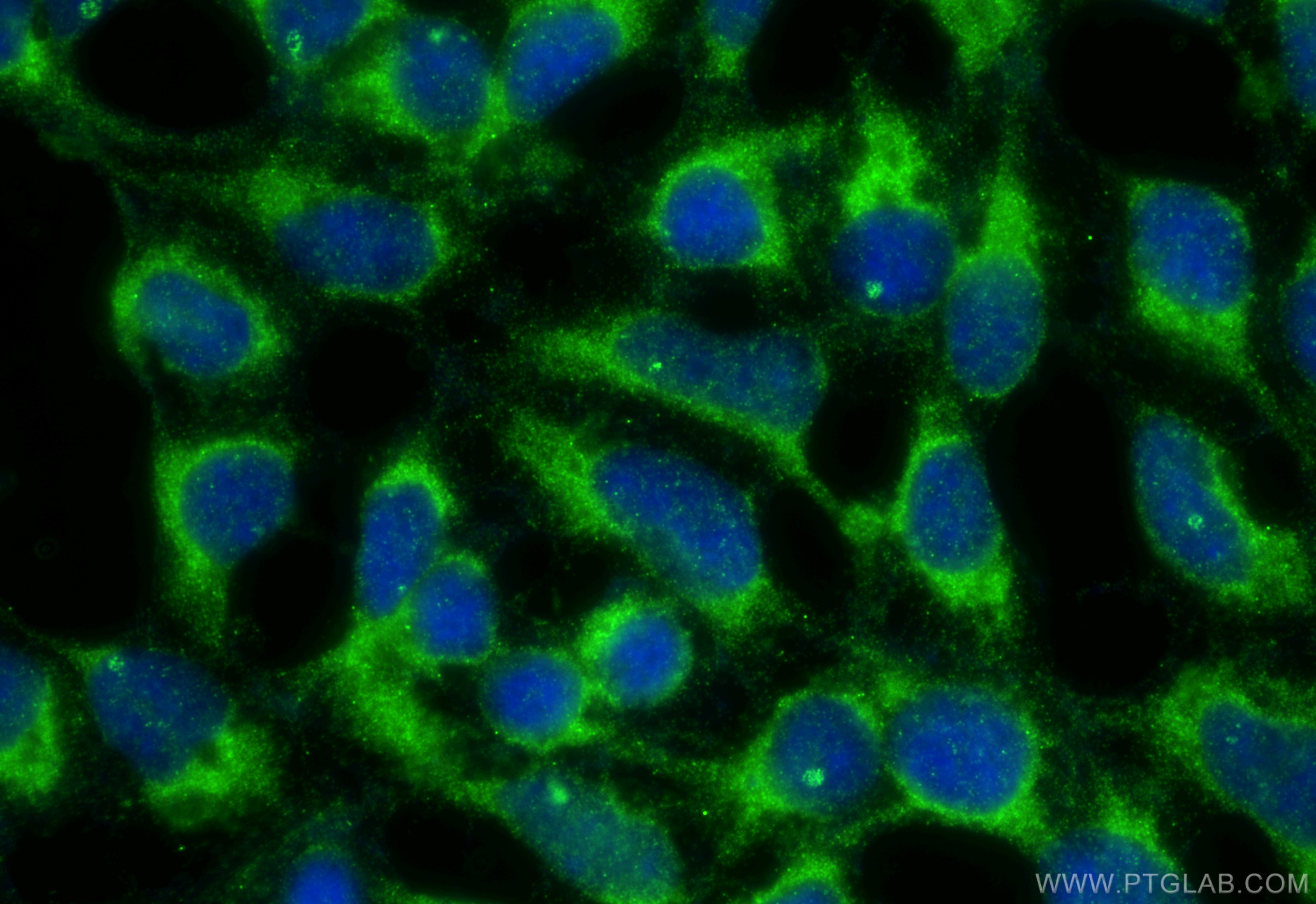 Immunofluorescence (IF) / fluorescent staining of HEK-293 cells using DNPEP Polyclonal antibody (15016-1-AP)