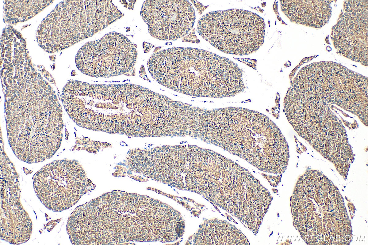 Immunohistochemistry (IHC) staining of mouse testis tissue using DNPEP Polyclonal antibody (15016-1-AP)