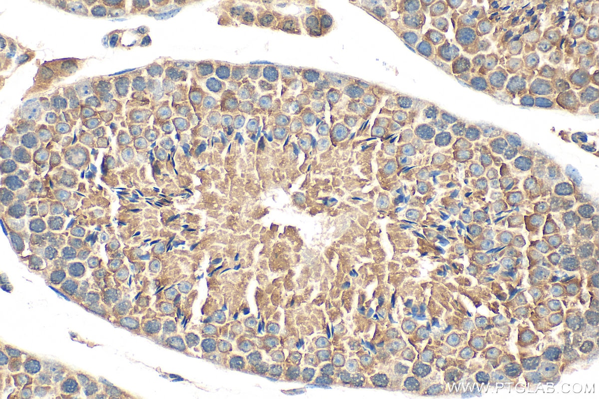 Immunohistochemistry (IHC) staining of mouse testis tissue using DNPEP Polyclonal antibody (15016-1-AP)