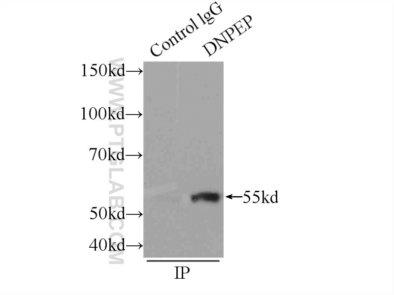 Immunoprecipitation (IP) experiment of HEK-293 cells using DNPEP Polyclonal antibody (15016-1-AP)
