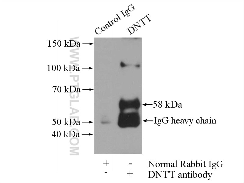 Immunoprecipitation (IP) experiment of Raji cells using DNTT,TDT Polyclonal antibody (17382-1-AP)