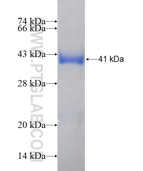 DNTT,TDT fusion protein Ag11235 SDS-PAGE