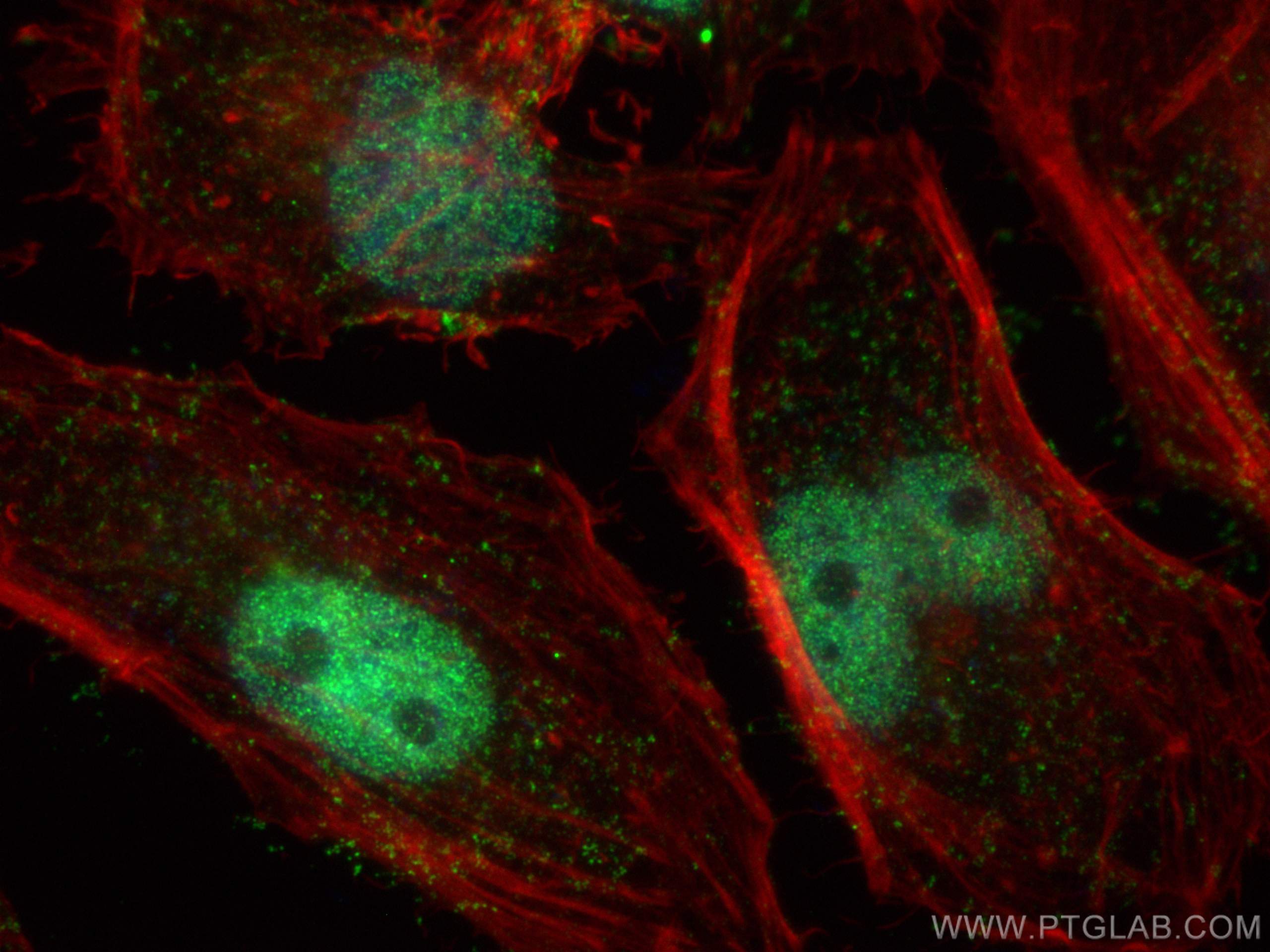 Immunofluorescence (IF) / fluorescent staining of HeLa cells using DNTTIP1 Polyclonal antibody (11637-1-AP)
