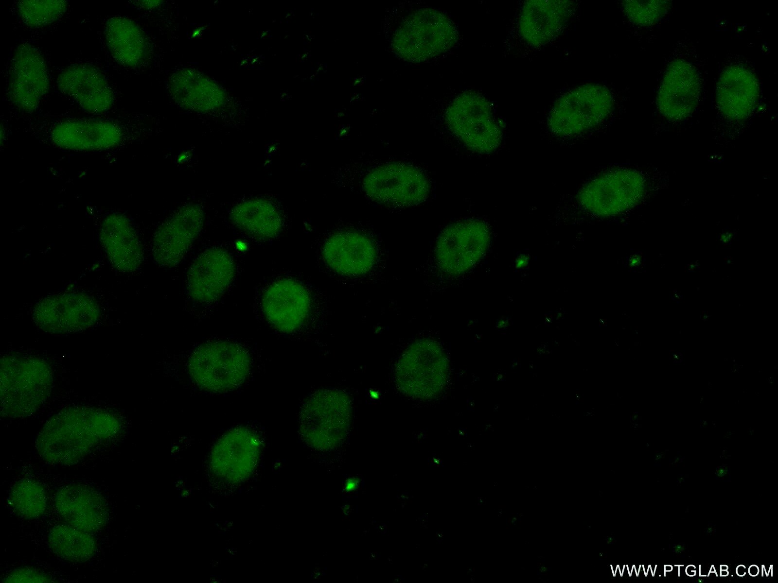 Immunofluorescence (IF) / fluorescent staining of HeLa cells using DNTTIP1 Polyclonal antibody (11637-1-AP)